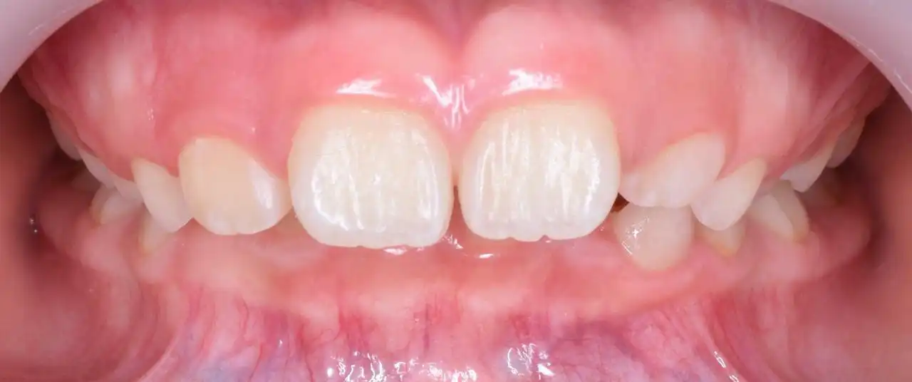 Odontopediatra