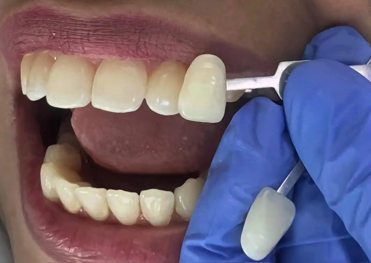 prótesis dental